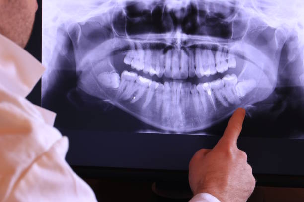 Best Urgent Tooth Repair  in Huntley, IL